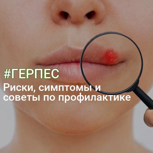 #ГЕРПЕС
